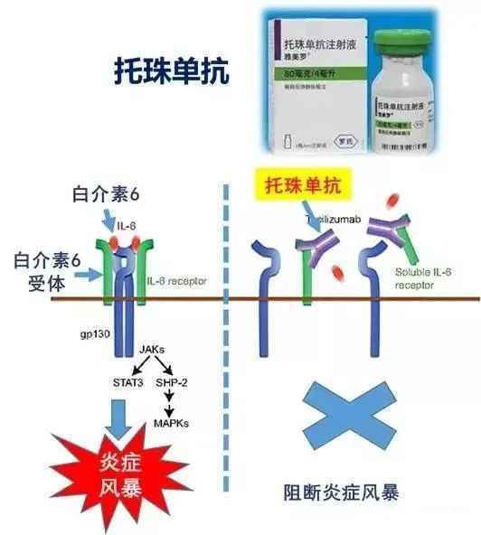 狙击炎症风暴拯救重症患者，托珠单抗是怎么做到的？