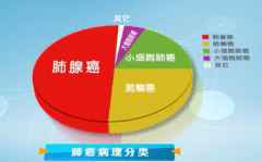 我国科学家首次揭示肺腺癌分子全景 潜在药物靶点触手可及